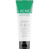 Some By Mi AHA-BHA-PHA 30 Days Miracle Acne Clear Foam - Очищающая пенка с кислотами