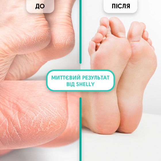 Shelly Gel-keratolytic for Removing Calluses and Corns "Soft blade" - Гель-кератолитик для удаления мозолей и натоптышей "Мягкое лезвие" - 4