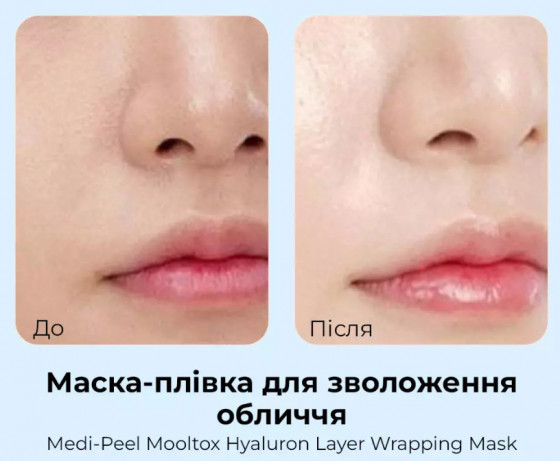 Medi-Peel Hyaluronic Acid Layer Mooltox Wrapping Mask - Увлажняющая маска-пленка для лица - 2